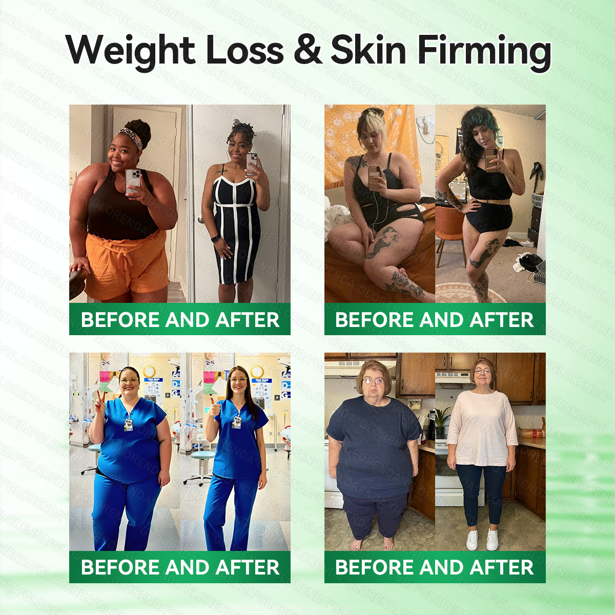 𝑶𝒇𝒇𝒊𝒄𝒊𝒂𝒍 𝑺𝒕𝒐𝒓𝒆  |🍀𝐂𝐚𝐫𝐞𝐔𝐩𝐥𝐢𝐟𝐭® 𝑴𝒆𝒕𝒂𝒃𝒐𝒍𝒊𝒄 𝑵𝒂𝒏𝒐 𝑴𝒊𝒄𝒓𝒐𝒏𝒆𝒆𝒅𝒍𝒆 𝑷𝒂𝒕𝒄𝒉🇺🇸(𝐉𝐮𝐬𝐭 𝐨𝐧𝐜𝐞 𝐚 𝐝𝐚𝐲, 𝐯𝐢𝐬𝐢𝐛𝐥𝐞 𝐜𝐡𝐚𝐧𝐠𝐞𝐬 𝐢𝐧 𝟕 𝐝𝐚𝐲𝐬）𝘽𝙚𝙧𝙗𝙚𝙧𝙞𝙣𝙚 + 𝙈𝙤𝙧𝙞𝙣𝙜𝙖 𝙁𝙤𝙧𝙢𝙪𝙡𝙖 ✅ 𝐅𝐨𝐫 𝐨𝐛𝐞𝐬𝐢𝐭𝐲, 𝗟𝗼𝗼𝘀𝗲 𝘀𝗸𝗶𝗻,𝐝𝐢𝐚𝐛𝐞𝐭𝐞𝐬, 𝐬𝐥𝐞𝐞𝐩 𝐚𝐩𝐧𝐞𝐚, 𝐣𝐨𝐢𝐧𝐭 𝐢𝐬𝐬𝐮𝐞𝐬, 𝐚𝐧𝐝 𝐦𝐨𝐫𝐞💯💯