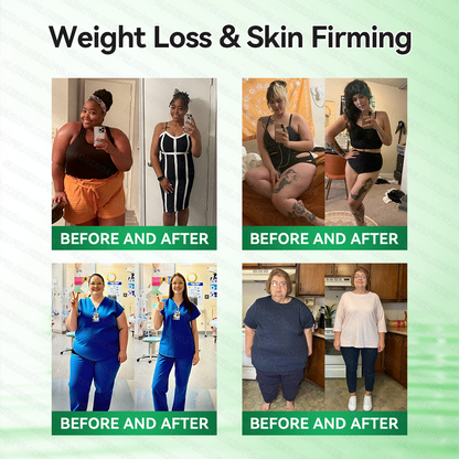 𝑶𝒇𝒇𝒊𝒄𝒊𝒂𝒍 𝑺𝒕𝒐𝒓𝒆  |🍀𝐂𝐚𝐫𝐞𝐔𝐩𝐥𝐢𝐟𝐭® 𝑴𝒆𝒕𝒂𝒃𝒐𝒍𝒊𝒄 𝑵𝒂𝒏𝒐 𝑴𝒊𝒄𝒓𝒐𝒏𝒆𝒆𝒅𝒍𝒆 𝑷𝒂𝒕𝒄𝒉🇺🇸(𝐉𝐮𝐬𝐭 𝐨𝐧𝐜𝐞 𝐚 𝐝𝐚𝐲, 𝐯𝐢𝐬𝐢𝐛𝐥𝐞 𝐜𝐡𝐚𝐧𝐠𝐞𝐬 𝐢𝐧 𝟕 𝐝𝐚𝐲𝐬）𝘽𝙚𝙧𝙗𝙚𝙧𝙞𝙣𝙚 + 𝙈𝙤𝙧𝙞𝙣𝙜𝙖 𝙁𝙤𝙧𝙢𝙪𝙡𝙖 ✅ 𝐅𝐨𝐫 𝐨𝐛𝐞𝐬𝐢𝐭𝐲, 𝗟𝗼𝗼𝘀𝗲 𝘀𝗸𝗶𝗻,𝐝𝐢𝐚𝐛𝐞𝐭𝐞𝐬, 𝐬𝐥𝐞𝐞𝐩 𝐚𝐩𝐧𝐞𝐚, 𝐣𝐨𝐢𝐧𝐭 𝐢𝐬𝐬𝐮𝐞𝐬, 𝐚𝐧𝐝 𝐦𝐨𝐫𝐞💯💯
