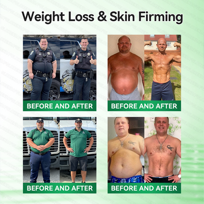 𝑶𝒇𝒇𝒊𝒄𝒊𝒂𝒍 𝑺𝒕𝒐𝒓𝒆  |🍀𝐂𝐚𝐫𝐞𝐔𝐩𝐥𝐢𝐟𝐭® 𝑴𝒆𝒕𝒂𝒃𝒐𝒍𝒊𝒄 𝑵𝒂𝒏𝒐 𝑴𝒊𝒄𝒓𝒐𝒏𝒆𝒆𝒅𝒍𝒆 𝑷𝒂𝒕𝒄𝒉🇺🇸(𝐉𝐮𝐬𝐭 𝐨𝐧𝐜𝐞 𝐚 𝐝𝐚𝐲, 𝐯𝐢𝐬𝐢𝐛𝐥𝐞 𝐜𝐡𝐚𝐧𝐠𝐞𝐬 𝐢𝐧 𝟕 𝐝𝐚𝐲𝐬）𝘽𝙚𝙧𝙗𝙚𝙧𝙞𝙣𝙚 + 𝙈𝙤𝙧𝙞𝙣𝙜𝙖 𝙁𝙤𝙧𝙢𝙪𝙡𝙖 ✅ 𝐅𝐨𝐫 𝐨𝐛𝐞𝐬𝐢𝐭𝐲, 𝗟𝗼𝗼𝘀𝗲 𝘀𝗸𝗶𝗻,𝐝𝐢𝐚𝐛𝐞𝐭𝐞𝐬, 𝐬𝐥𝐞𝐞𝐩 𝐚𝐩𝐧𝐞𝐚, 𝐣𝐨𝐢𝐧𝐭 𝐢𝐬𝐬𝐮𝐞𝐬, 𝐚𝐧𝐝 𝐦𝐨𝐫𝐞💯💯